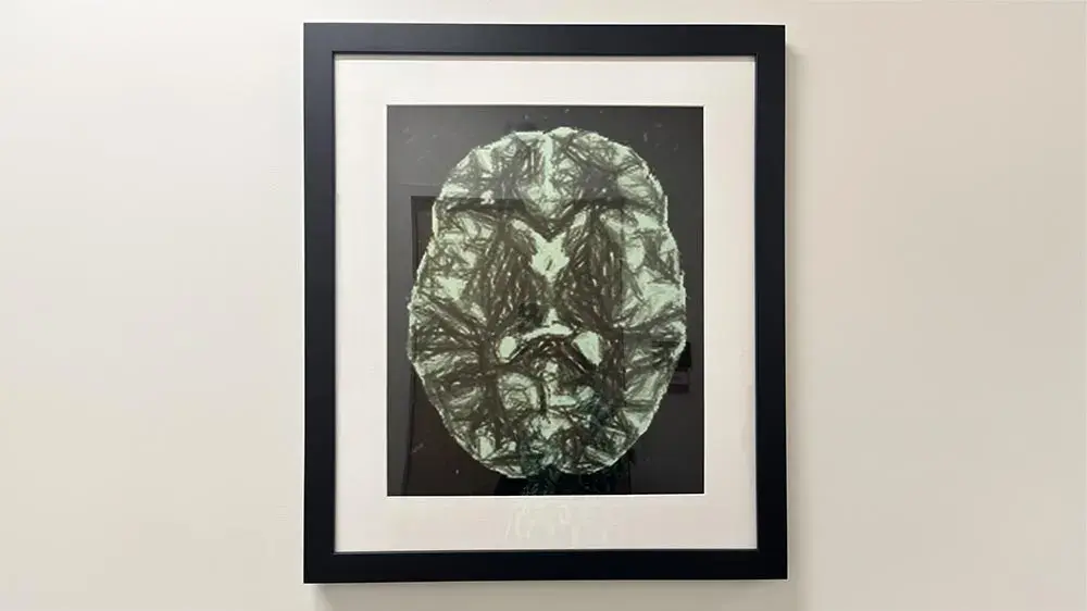 Framed brain scan image in black, white, and light green